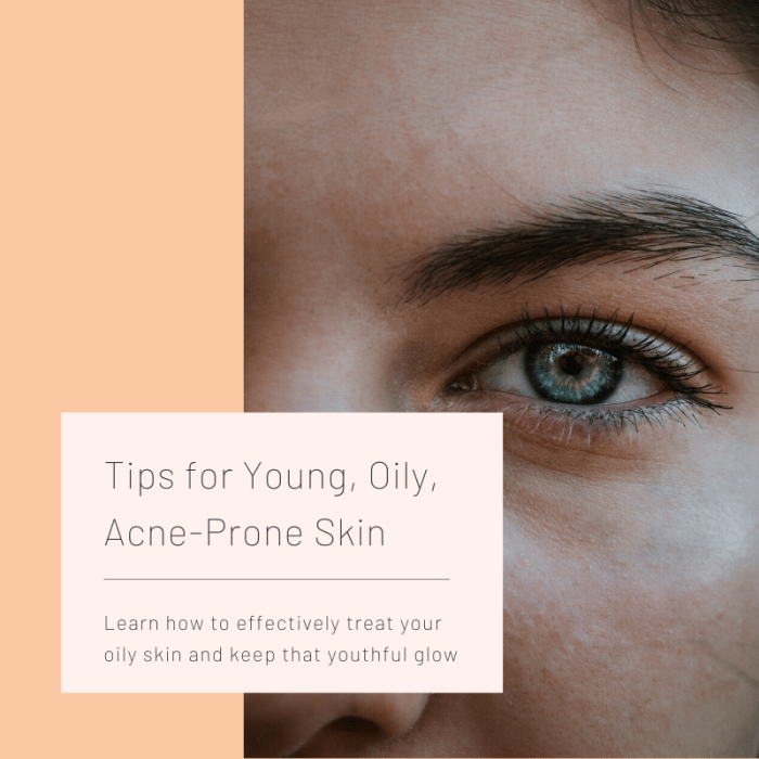 This article will provide some tips and guidance on how to effectively treat your oily, acne-prone skin.