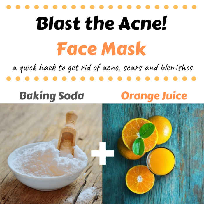 This is a great mask for eliminating acne, blackheads, pimples and acne scars!