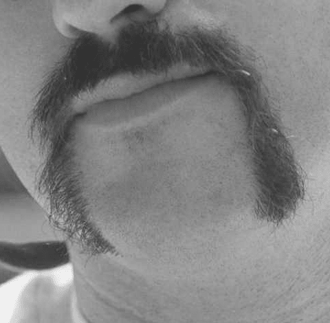 The horseshoe mustache.