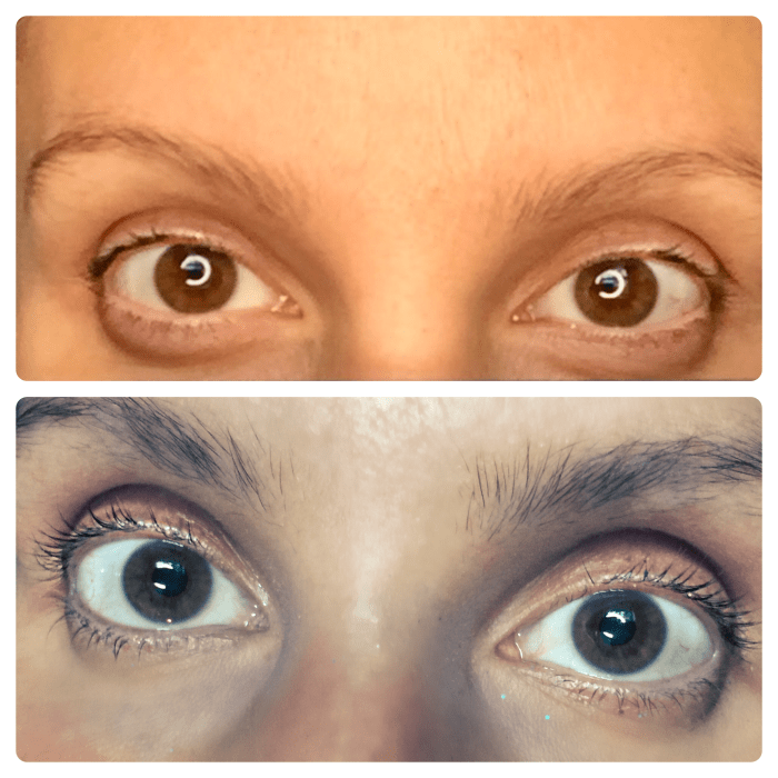 Top picture is before and bottom is after about 5 weeks. I am also using their other product, Rapidlash. As you can see it works too (I wrote a separate review for that.)