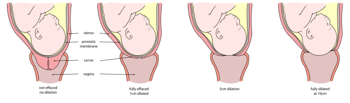 Cervix Effacement and Dilation: The cervix may begin to efface and dilate at this stage of the pregnancy.