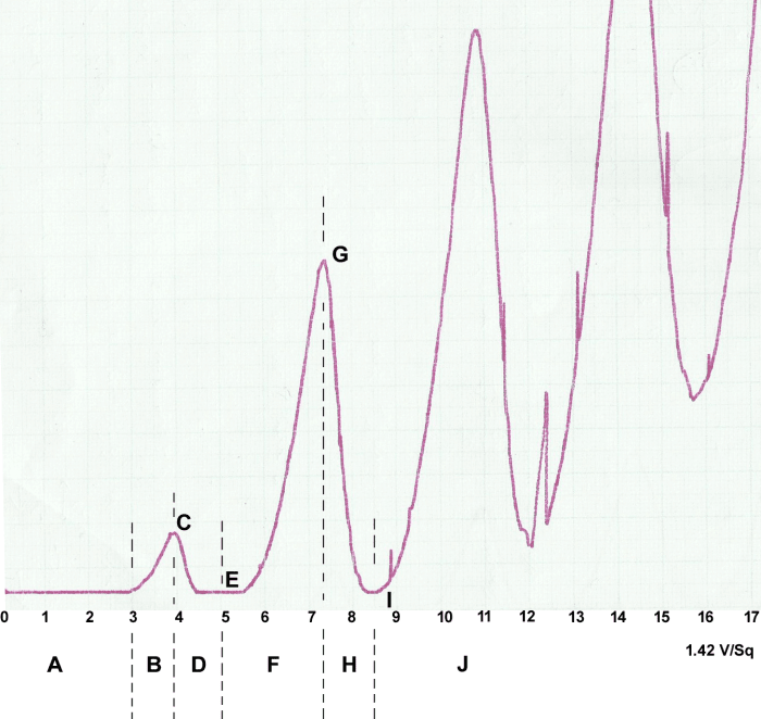 Data collected using mercury vapour heated to 150 Celsius within the Franck-Hertz tube. Current is plotted as a function of accelerating voltage. Note that the general pattern is important and not the sharp jumps which are simply experimental noise.