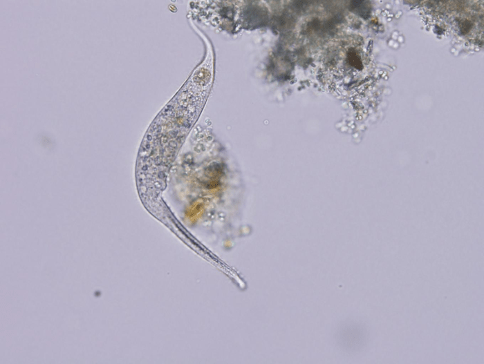 A typical protozoan of a kind commonly found in pond water and seen through a light microscope.