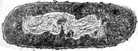 The DNA is in one long strand kept in a special area of the cytoplasm called the Nucleoid. It may look dark on a micrograph, but don't make the mistake of calling it a Nucleus!