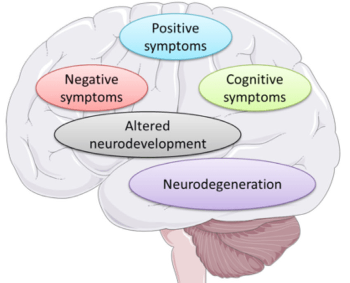 Before assuming Lia has schizophrenia, it is crucial to remember that the disease is only one possible cause of psychosis; a schizophrenia diagnosis is also contingent on the presence of a range of specific symptoms, not just delusions .