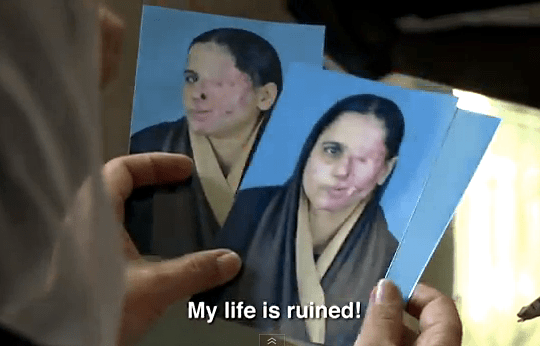 A still shot from the documentary "Saving Face". Zakia holds photos of her disfigurement by acid attack as she explains how her attacker (her husband) has not yet been punished.