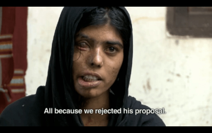 This woman was attacked with acid twice (once on her shoulder and later on her face) for rejecting a marriage proposal.