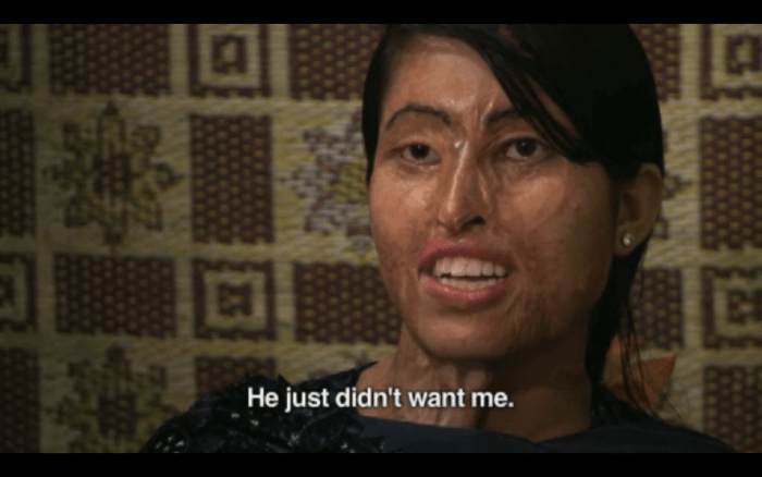 This woman's husband threw acid on her while she slept, simply because he didn't want her anymore.