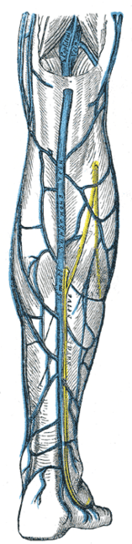 The small saphenous vein, on the lower back calf of the leg is also commonly treated with Endovenous Laser treatment.
