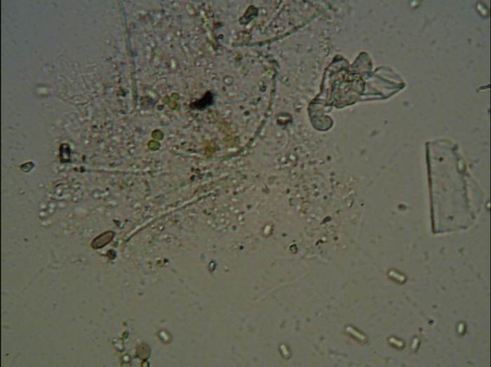 Collection of organic matter, primarily food for micro-organisms, some bacteria and other single celled organisms can be seen.