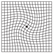 What a person may see if they have macular pucker. A person with macular degeneration may see the same thing since both diseases affect the macula but they are not the same disease. For my condition, the lines are wavy but not this dramatic.