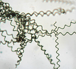 spiral spirulina filaments
