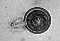 A microscopic view of ann oospore of Phytophthora infestans, the fungus that causes late blight of potato.