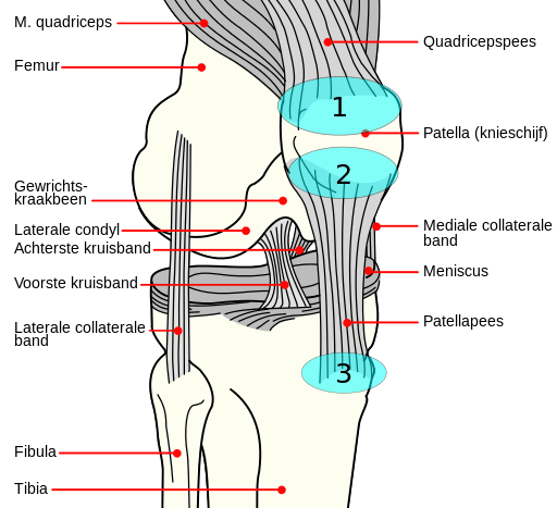 Patellar Tendinopathy In Action