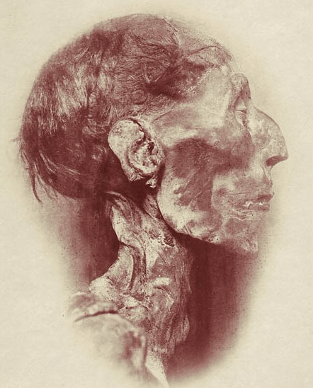 This is a photograph of the mummy of Ramses II, one of Ancient Egypt's greatest pharaohs. In order to take this picture, the bandages wrapping the mummy were removed, which unfortunately exposed the mummy to the elements and damaged it.