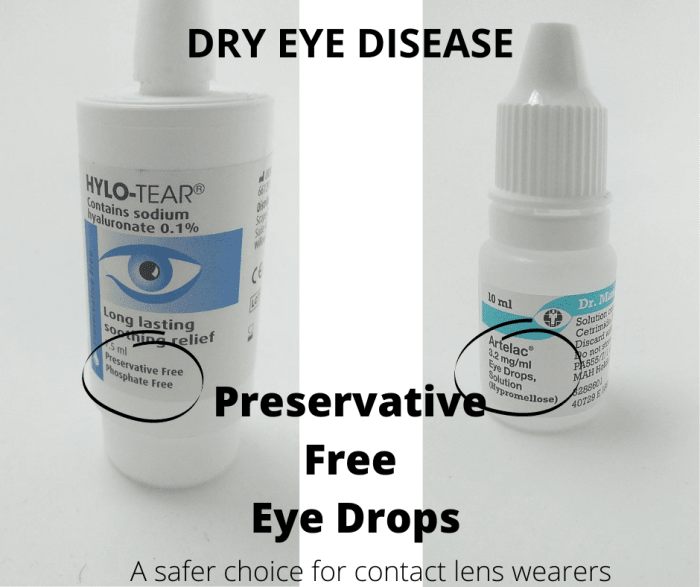Most people never have a problem with eye drops that contain a preservative. Artelac eye drops are not preservative free eye drops but Hylo Tear is.