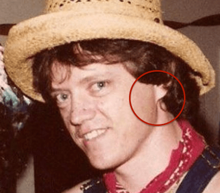 Clinton's earlobe is entirely attached. It is important to note that this is not a dominant trait; most earlobes are unattached.