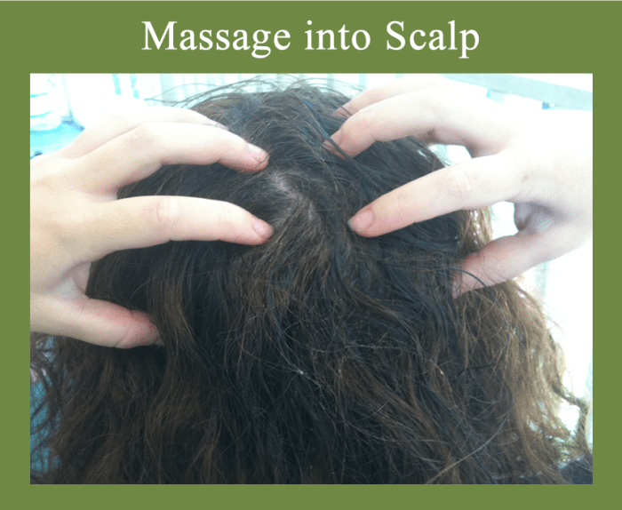 Natural Scalp Psoriasis Treatment With Tea Tree Oil and Olive Oil
