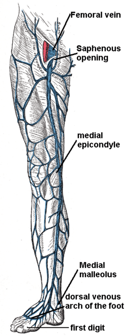 A Saphenectomy is having the Great Saphenous vein (& thereby the entire superficial venous system) removed in one leg.