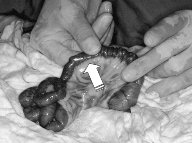 Veterinary surgeon palpating a linear foreign body inside the intestine of a cat. The white arrow points to the part of the intestine where is the linear foreign body. You can observe that the intestine is dilated and inflamed.