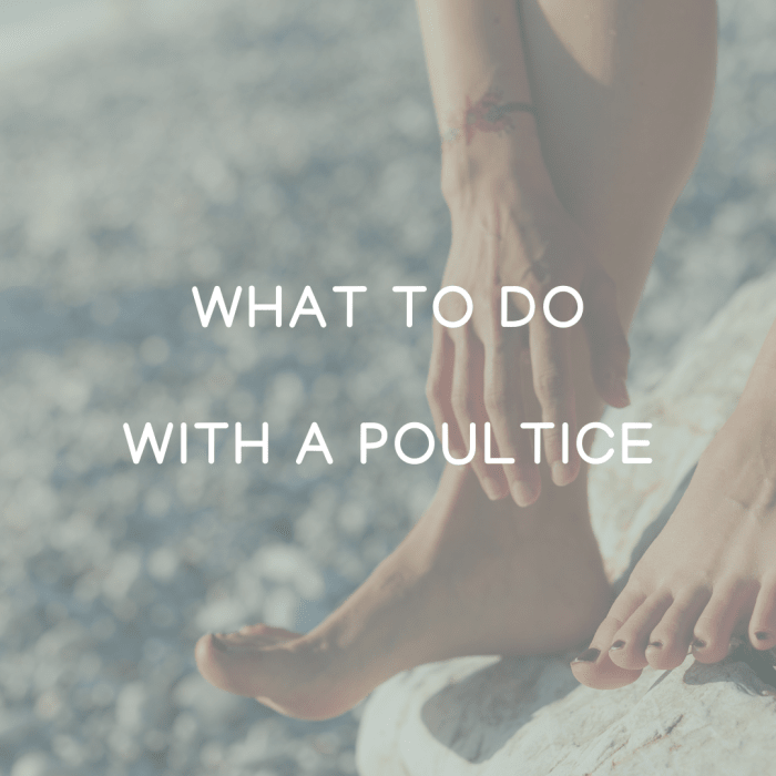 How to Make a Poultice for Removing Splinters, Boils and Abscesses ...