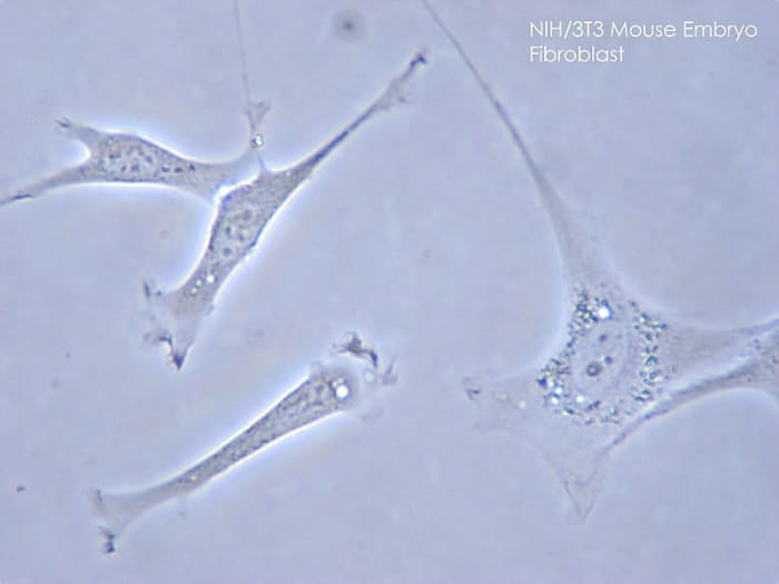 Fibronectin: A Cell Adhesion and Blood Clotting Protein - Owlcation