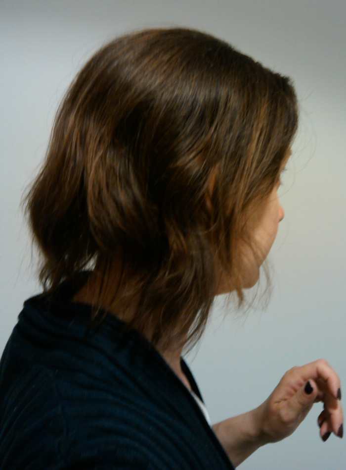 Hair Loss During Chemotherapy: My Journey With FEC-T - Patient's Lounge