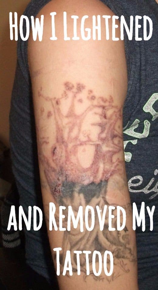 My Experience Lightening and Removing My Tattoo at Home - HubPages