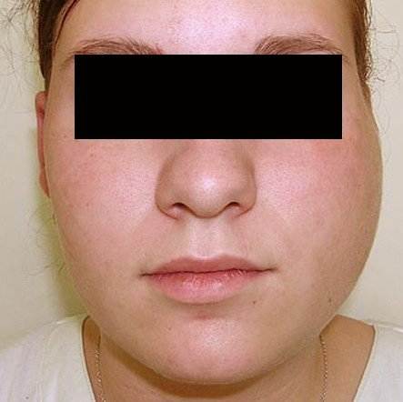 the salivary glands are also known as your "parotid glands.