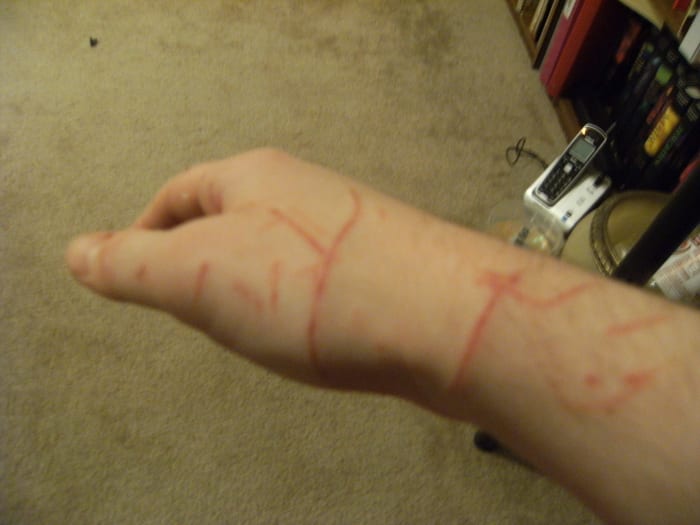 Treating Cat Bites and Scratches - HubPages