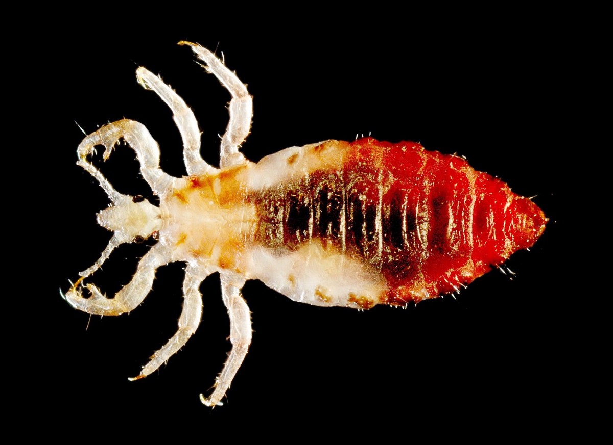 The body louse