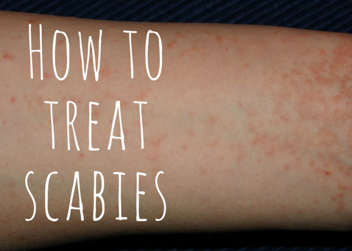 Scabies medications