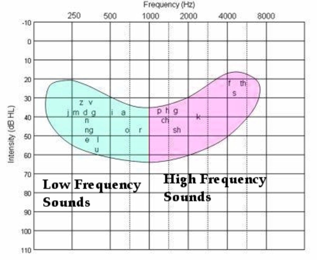 The Best Hearing Loss Simulations: Understanding Audiograms and the Impact of the Speech Banana
