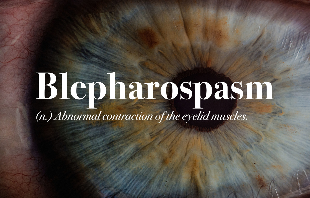 My Experience With Blepharospasm and Uncontrollable Eye Blinking