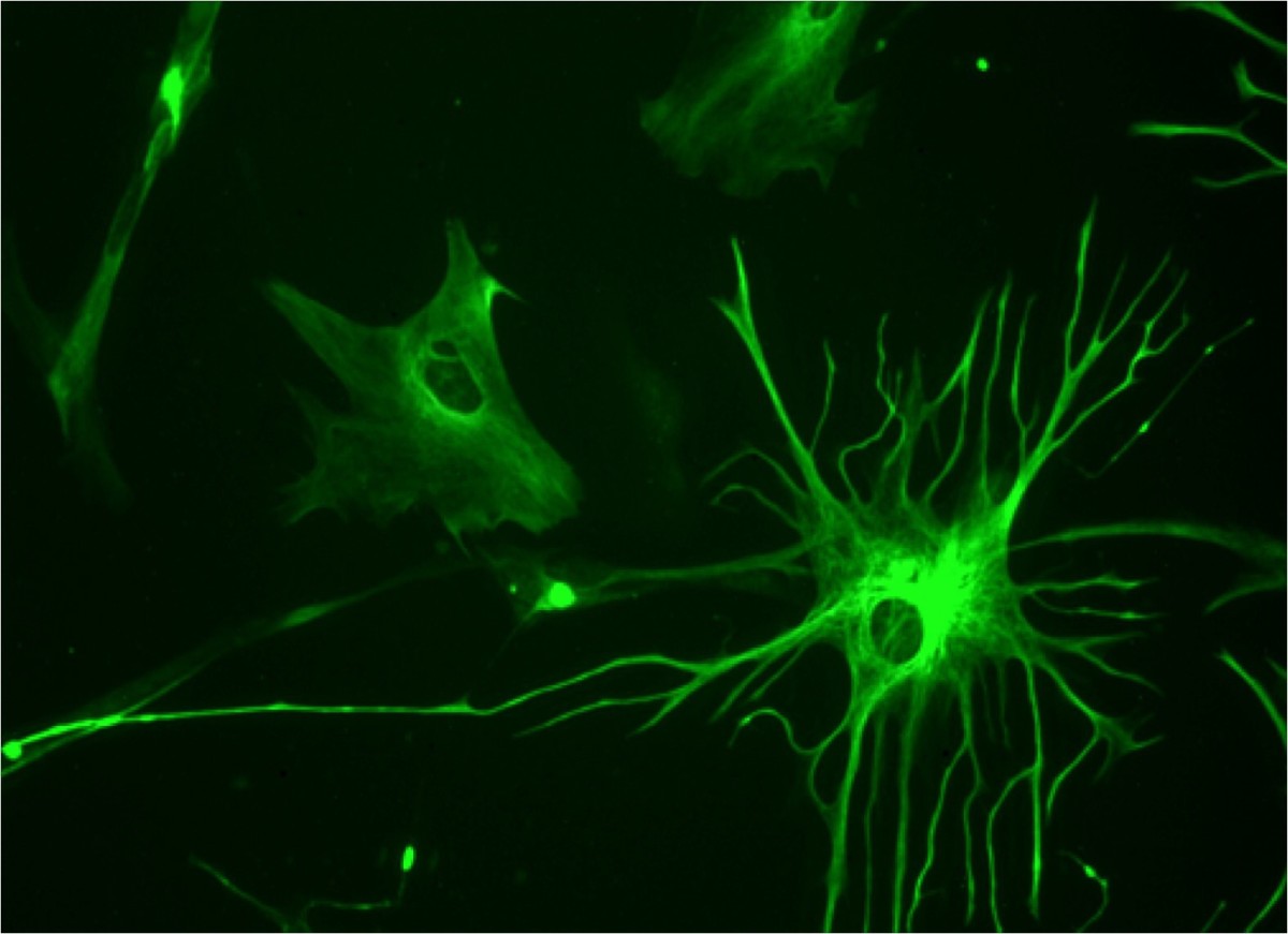 Astrocytes, Neurons, and Amyotrophic Lateral Sclerosis (ALS)