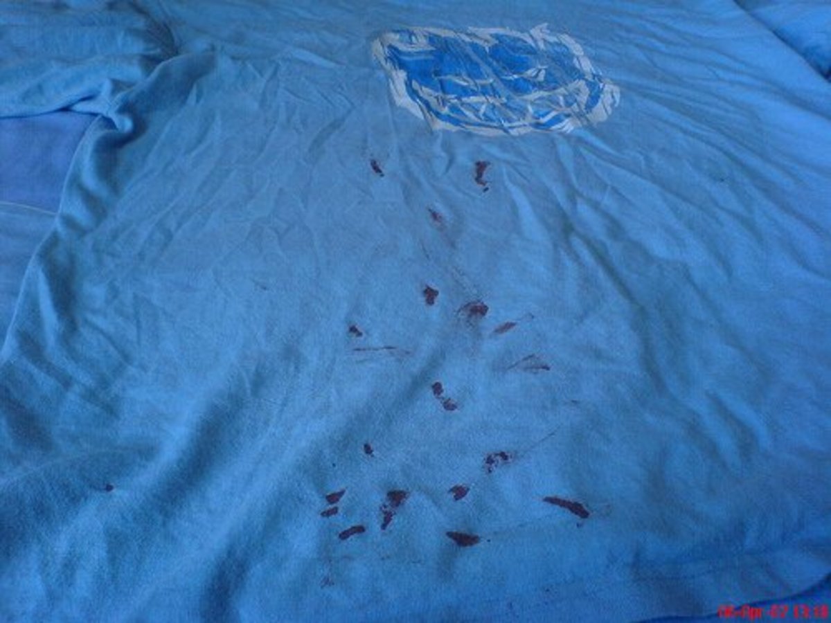 You CAN remove blood stains from clothes, even dried ones like these.