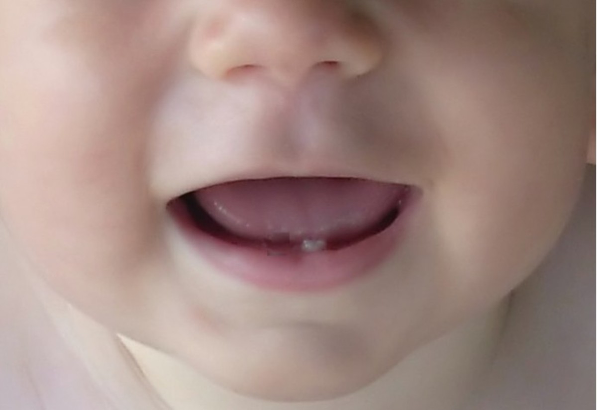 As soon as your baby's first tooth pokes through, it's time for the Agra Hadig celebration!