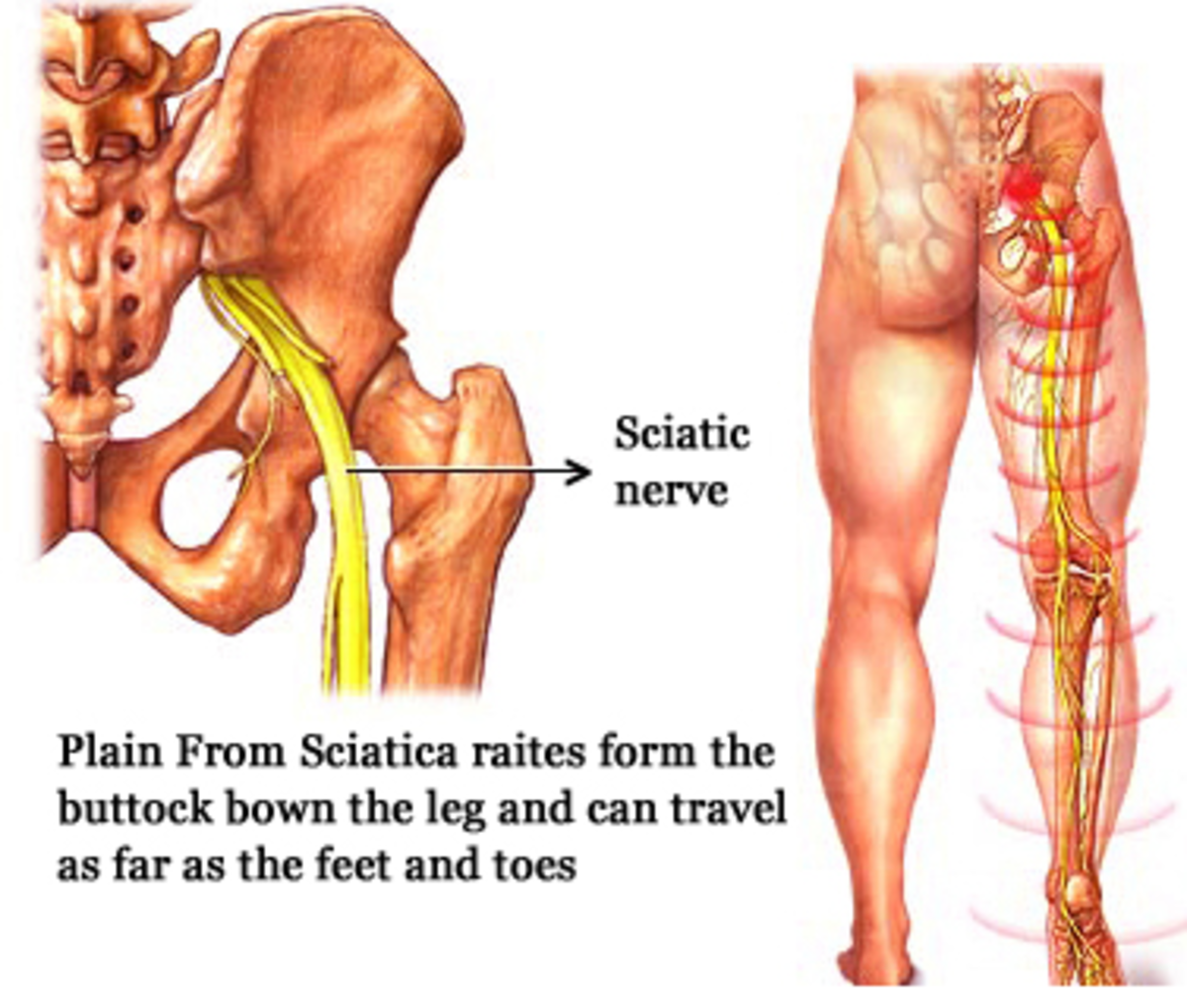 Control Lower Back Pain and Arthritis