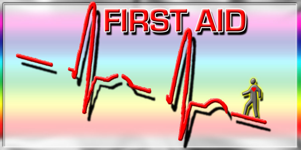 First Aid Basic Steps