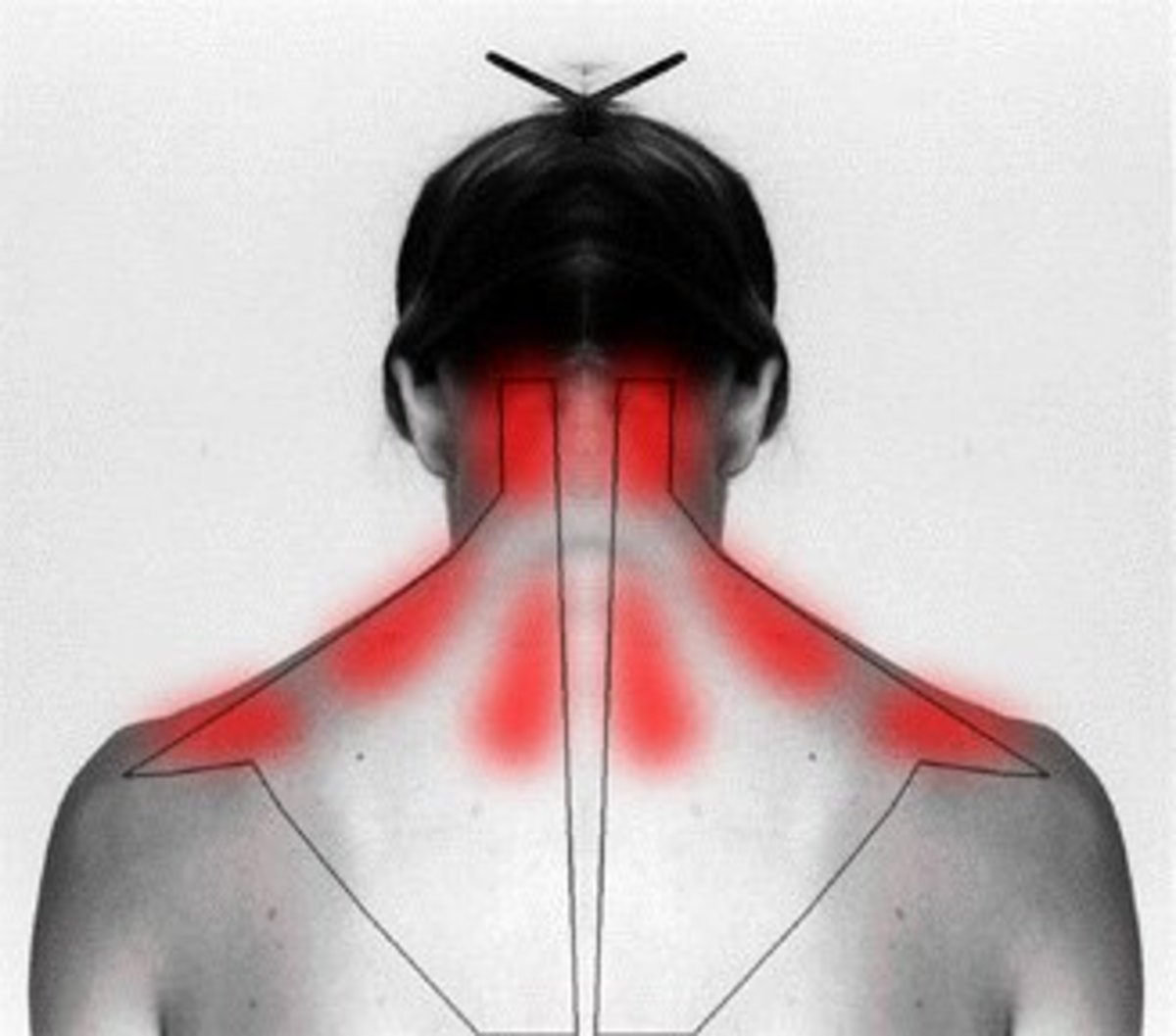 How To Cure Head Ache And Neck Pain With Passive Spine And Neck Stretch To Ease The Pain 