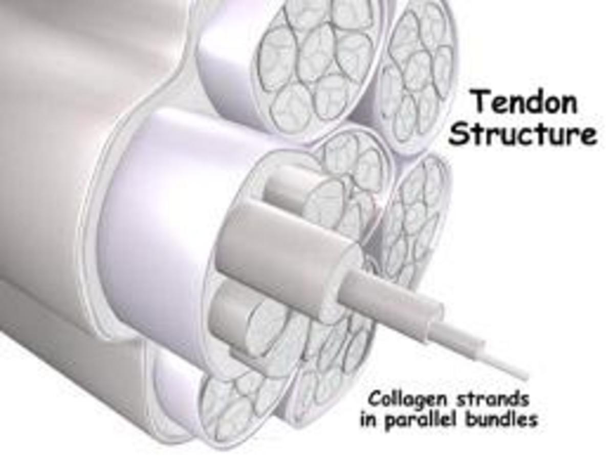 My Experience and Treatment for Tendinosis (Not Tendinitis)