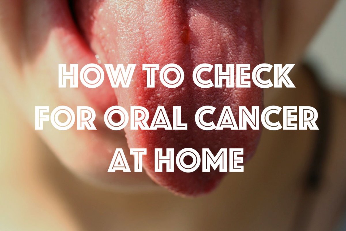 How to check for oral cancer at home
