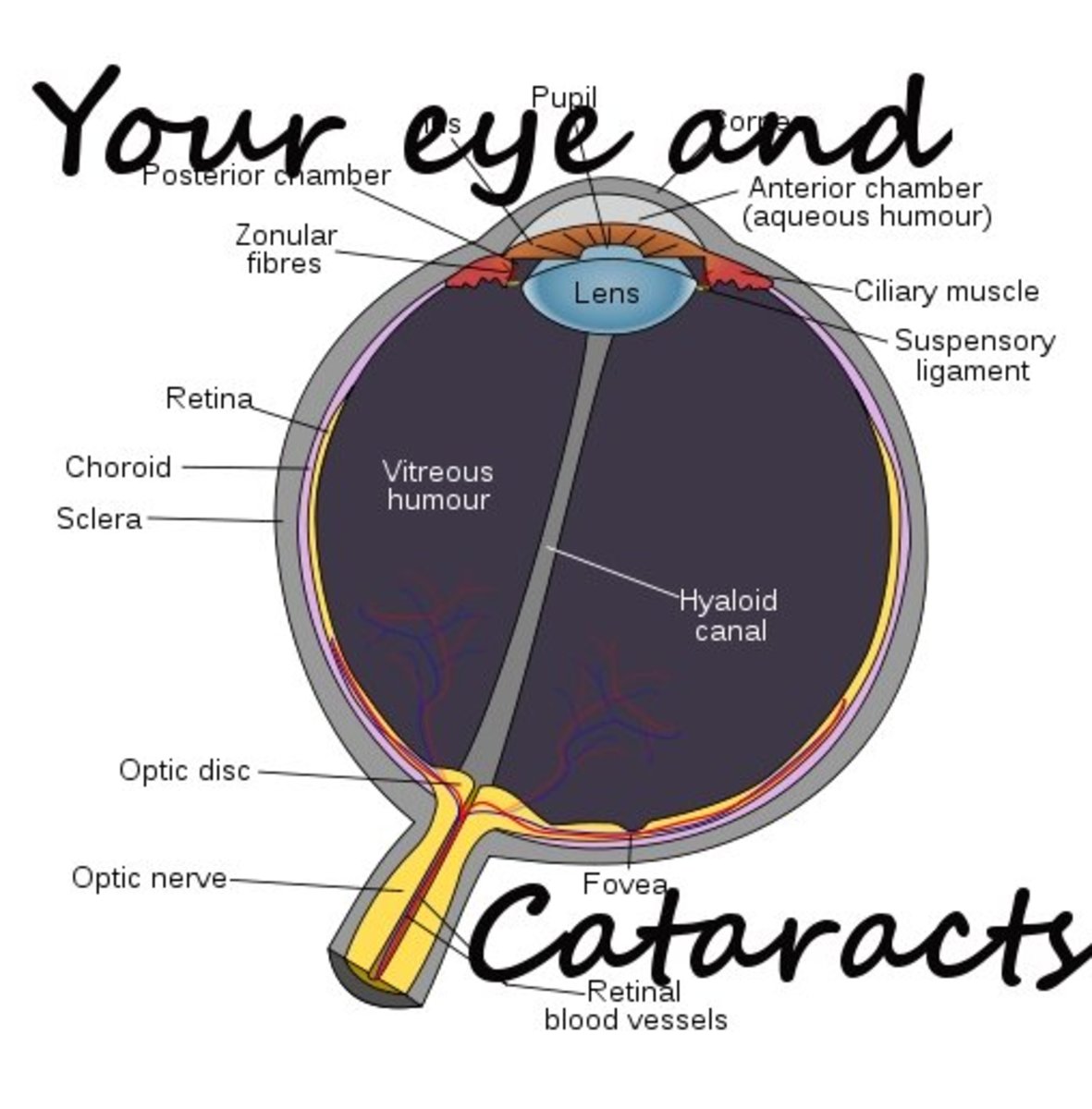 How Cataracts Affect Your Eyes