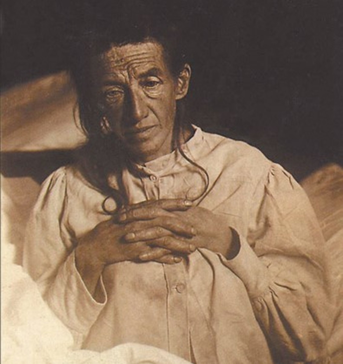 Auguste Deter, First Alzheimer's Diagnosis 1901.