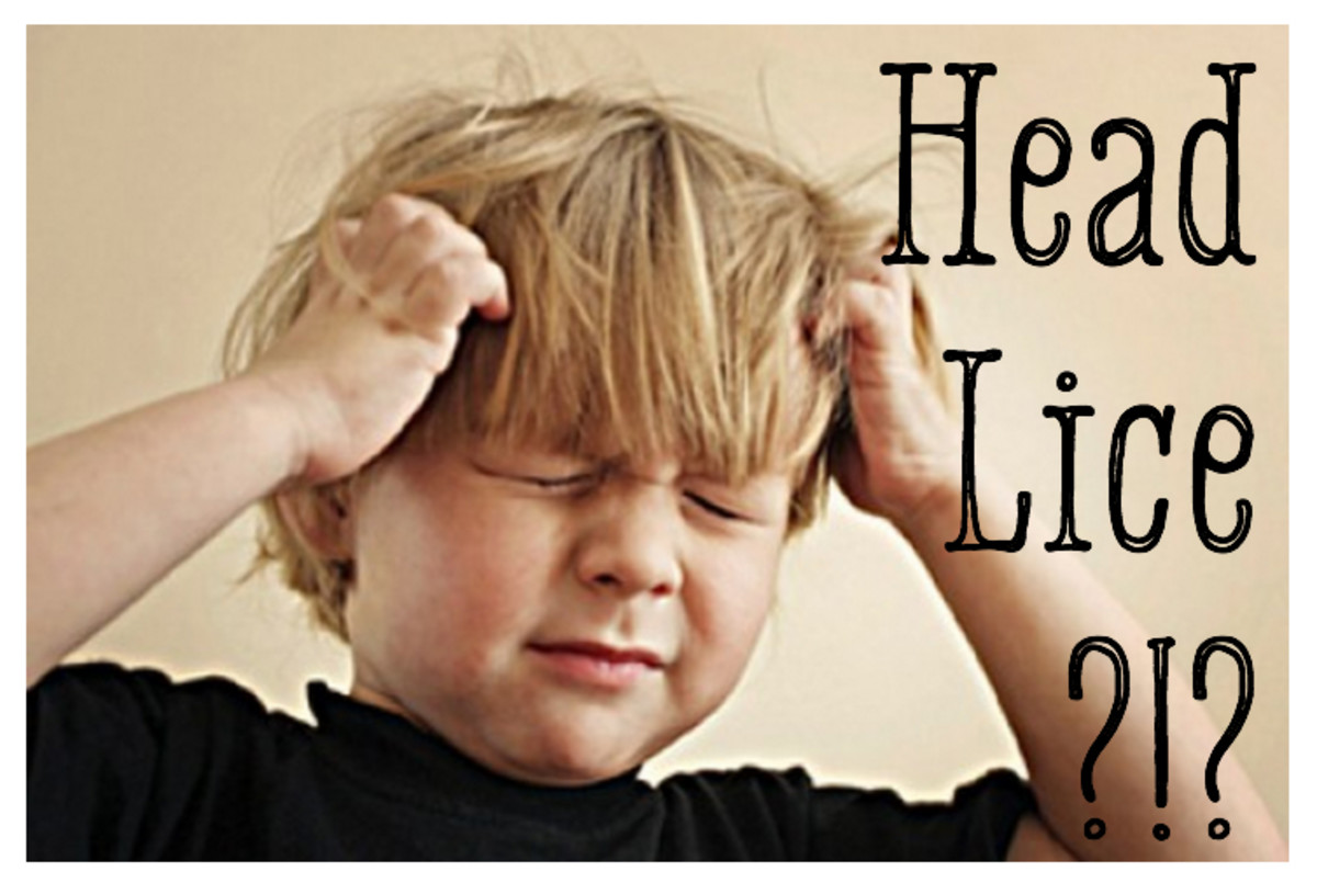 How To Get Rid Of Head Lice Permanently Remedygrove