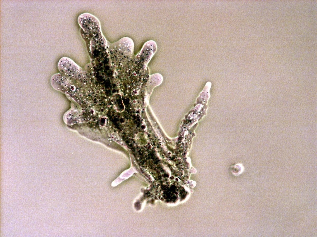 The shape of Amoeba proteus is constantly changing. This is what a specimen looked like at one moment in time.