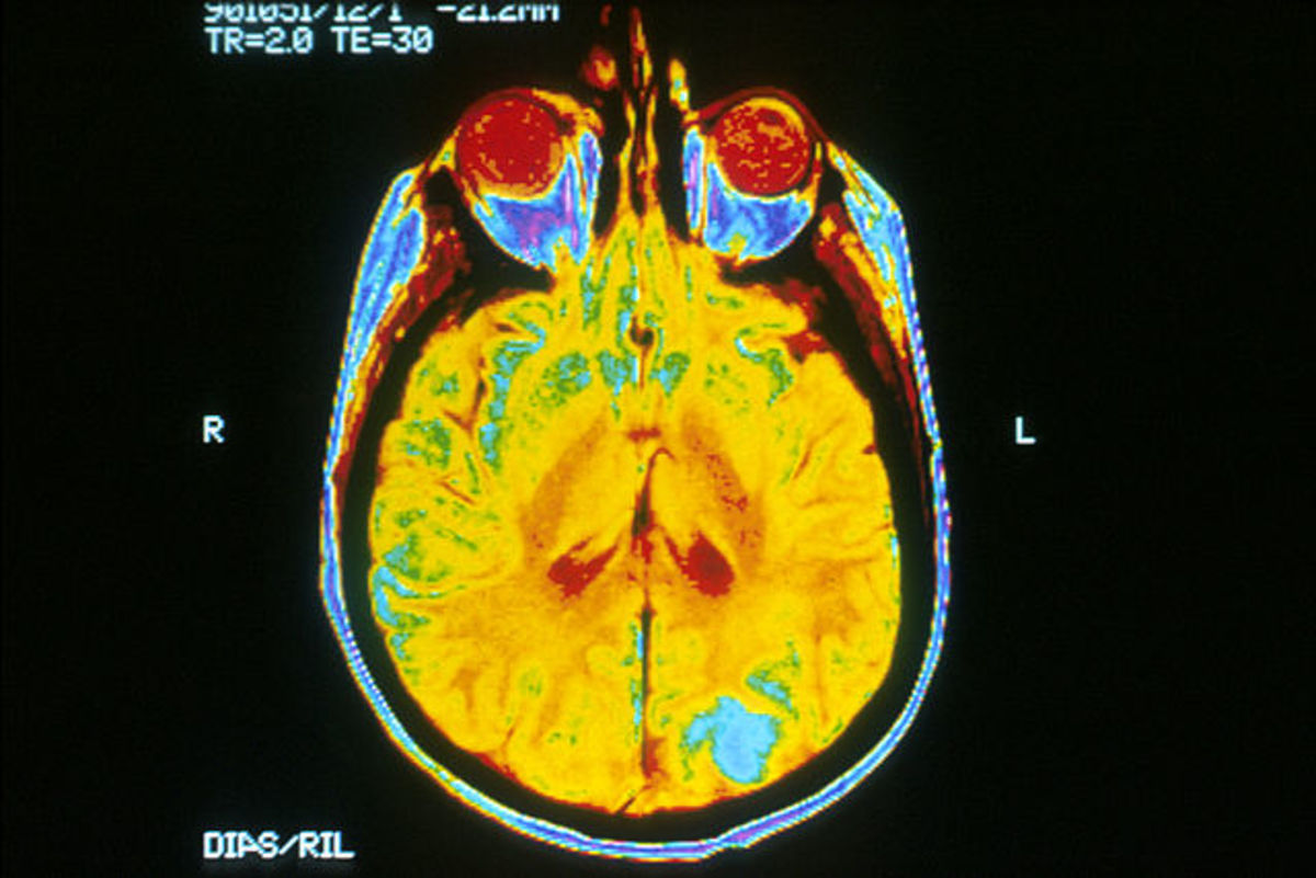 A single image of a human brain using a magnetic resonance imaging (MRI) machine. 