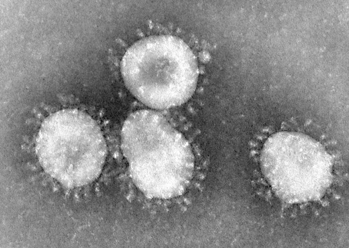 A picture of coronavirus virions (individual entities) as seen through an electron microscope; the virus is known for the spikes on its surface