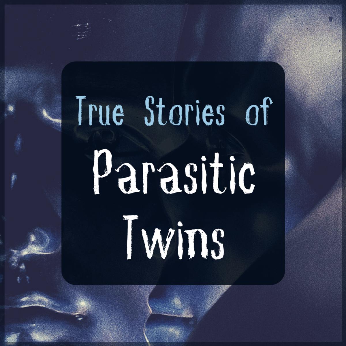 探索一些寄生双胞胎的真实故事。