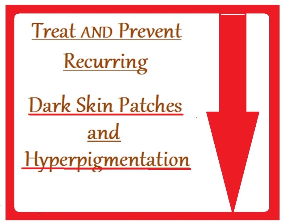 Hyperpigmentation Treatment and Prevention of Dark Skin Patches